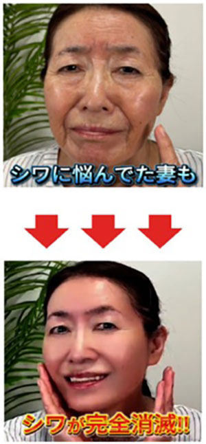 消費者庁が美容クリーム３社を特商法で処分、誇大広告と誤認表示で